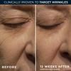 RoC Retinol Correxion Night Cream for Deep Wrinkles, Anti Aging Skincare Treatment Women and Men, 1.0 oz (Packaging May Vary) view 4