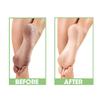 ProLinc Dry Heel Eliminator | Protect And Hydrate Dry Heels And Feet | Fast Absorbing And Non Greasy | Made In The USA | 4 Fl. Oz. view 2