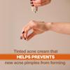 Adult Acnomel Acne Medication Cream, 1.3 Ounces view 2