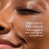Kat Burki Rose Hip Intense Recovery Eye Serum with 1% Encapsulated Retinol, Vitamin C & Niacinamide, Reduces Dark Circles, Puffiness & Fine Lines, 0.5 Fl Oz view 2