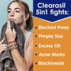 Clearasil Stubborn Acne Control 5in1 Spot Treatment Cream, 1 oz view 2