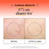 Derma E Problem Skin Cleanser, 6 FZ view 3