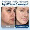 Clean Skin Club Clean Towels XL, 100% USDA Biobased Face Towel, Disposable Face Towelette, Eczema Association Accepted, Makeup Remover Dry Wipes, Ultra Soft, 50 ct per pack, 2 Packs, 100 Ct Total view 3
