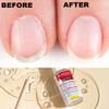 MAVALA Cuticle Remover for Overgrown Cuticles, 0.3-ounce | Softens Cuticles | Fast Acting | Form Neat Nail Contour | Gently remove Dead Cells from Cuticle view 2