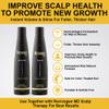 Revivogen MD Bio-Cleansing Shampoo and Conditioner for Thinning Hair, DHT Blocker Shampoo, Hair Loss Shampoo, Shampoo Thinning Hair, Conditioner for Thinning Hair, Hair Loss Conditioner 12oz view 3