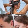 Hair Loss Shampoo | Hair Regrowth Shampoo For Thinning Hair | Hair Growth Product For Men and Women | Just Nutritive | 16 Oz view 3