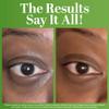 TruSkin Peptide Eye Cream Gel for Dark Circles, 0.5 fl oz view 4