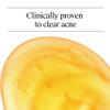 Neutrogena Oil Free Acne Face Wash, 9.1 fl. oz, 3 Pack view 3