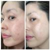 AntiAging Peel Pads-30% Glycolic Cell Renewal Peel Pads+ Salicylic, Lactic Acid, Argireline, DMAE view 3