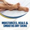 Gold Bond Healing Foot Cream, 4 oz. (Pack of 4), With Aloe, Nourishes & Softens For Healthier Looking Feet view 4