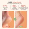ZenToes Moisturizing Socks for Cracked Heel Treatment, Vitamin E, Olive Oil and Jojoba Oil Heel Socks, Stocking Stuffers for Women, Spa Self Care Gifts for Women (Fuzzy Blue and Pink, Regular) view 3