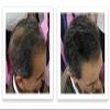 Caboki Hair Loss Concealer. All-Natural Hair Building Fiber. Make Thin Hair Look 10X Fuller Instantly. Eliminate the Appearance of Bald Spot and Thinning Hair (30G, 90-Day Supply). Salt & Pepper-Dark view 4