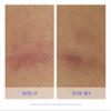 iS CLINICAL Super Serum Advance+, Anti-Aging Vitamin C Face Serum, reduces scaring and fine stretch marks, 0.5 Fl Oz view 4