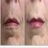 Youth Serum Anti-Aging with Ubiquinone 4% Ubiquinone and 20% Argireline. Also contains DMAE, Hyalronic Acid, Jojoba, Aloe Vera extract, and so much more. PARABEN FREE! New heat sealed airless 1 oz/30ml bottle. view 4