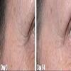 True Radiance Lineless Eye cream removes crows feet, dark circles and Puffiness, fine lines. Anti-aging, anti-wrinkle and more. Also has 10% Reguage, 10% Syncoll, 8% Pepha-tight, DMAE, Glycerin and much more. PARABEN FREE 1 oz eye cream. view 3