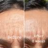 Retinol & Lactic 10% Resurfacing Treatment view 4
