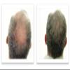 Caboki Hair Loss Concealer. All-Natural Hair Building Fiber. Make Thin Hair Look 10X Fuller Instantly. Eliminate the Appearance of Bald Spot and Thinning Hair (30G, 90-Day Supply).Salt & Pepper-Light view 3