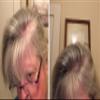 Caboki Hair Loss Concealer. All-Natural Hair Building Fiber. Make Thin Hair Look 10X Fuller Instantly. Eliminate the Appearance of Bald Spot and Thinning Hair (30G, 90-Day Supply).Salt & Pepper-Light view 4