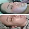 Herbal Power Peel- Chemical & Acid Free Green Herbal Deep Sea Algae Peel-Professional or Home Use view 4