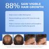 BosRevive Nourishing Shampoo for Noticeably Thinning, Non Color-Treated Hair Helps Restore Thinning Hair & Remove DHT, Product & Pollution Build-Up, Boosts Scalp Circulation, Sulfate-Free 33.8 Fl Oz view 2