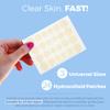Acne Patches for Face - Hydrocolloid Bandages (24 Count) Pimple Patches for Face in 3 Universal Sizes, Acne Spot Treatment Care for Face & Skin Spot Patch Conceals Zits, Acne and Blackheads view 2