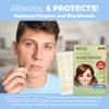 Acne Patches for Face - Hydrocolloid Bandages (24 Count) Pimple Patches for Face in 3 Universal Sizes, Acne Spot Treatment Care for Face & Skin Spot Patch Conceals Zits, Acne and Blackheads view 3