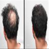 LUXE Hair Building Fibers - Thickening Fibers - CONFIDENCE IN A JAR  2 Months+ Supply!  Hypoallergenic, Dermatologist Tested  Multiple Colors Available (Medium Brown) view 2