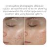 Epionce Lite Lytic Tx Facial Retexturizing Lotion - Blemish, Pore Minimizer view 3