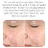 Epionce Lytic Gel Cleanser  Gentle Foaming Face Wash & Makeup Remover | For Oily, Combination & Problem Skin | Acne & Oil-Control Cleanser with Willow Bark | Dermatologist Skincare view 4