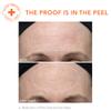 Dr. Dennis Gross Alpha Beta Ultra Gentle Daily Peel: for Dehydrated or Sensitive Skin, Uneven Tone or Texture, Fine Lines or Enlarged Pores (30 Treatments) view 4