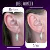 Lobe Wonder - The ORIGINAL Ear Lobe Support Patch for Pierced Ears - Eliminates the Look of Torn or Stretched Piercings - Protects Healthy Ear Lobes from Tearing - 420 Patches - Clear & Latex-Free view 3
