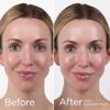 EltaMD UV Daily SPF 40 Face Sunscreen Moisturizer with Zinc Oxide, Daily Face Moisturizer with SPF, Sunscreen, For Dry Skin 1.7 oz Pump view 4