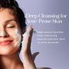 Hylunia Facial Cleansing Gel, 5.1 fl. oz. view 4