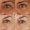 skyn ICELAND Hydro Cool Firming Eye Gels: Under-Eye Gel Patches to Firm, Tone and De-Puff Under-Eye Skin, 8 Pairs view 3