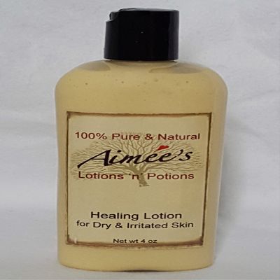 All Natural Healing Lotion ~ for Eczema, Psoriasis & Dermatitis