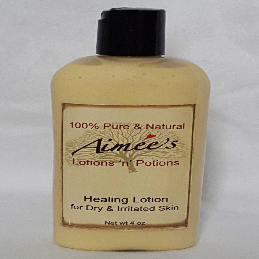 All Natural Healing Lotion ~ for Eczema, Psoriasis & Dermatitis