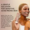 BOLDEN Clear Skin Clay Mask | Made with Sulfur for Deep Pore Cleansing & Preventing Breakouts | Pore Minimizer and Oil Reducer for Sensitive Skin | 3.5 fl oz view 3
