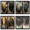3 x Allure Hair Building Fibers (HBF) (22g) (Black) view 3