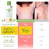 Skin MD Shielding for Face and Body, Relief for Irritated and Itchy Skin with Psoriasis (8 Ounce) view 2