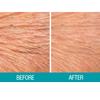 Dermactin Crepe Skin Firming Cream 2.5 oz. view 4