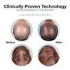 Capillus Pro Mobile Laser Therapy Cap for Hair Regrowth, with 272 Red Light Lasers for Laser Hair Growth, Red Light Hair Growth view 2