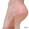Du'it Foot & Heel Balm Plus 50ml view 2