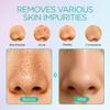 VOYOR Blackhead Remover Pore Vacuum - Electric Face Vacuum Pore Cleaner Acne White Heads Removal with 6 Suction Heads (BR410) view 3