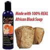Acne Killer Liquid African Black Soap Body Wash Conditions Skin and Cleanses Pores - 4 floz view 3