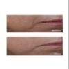 Perricone Md Cold Plasma Plus+ Advanced Serum Concentrate, 2 Oz view 3