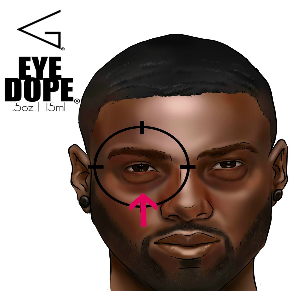 EYE DOPE [ERADICATES DARK CIRCLES & BAGS]
