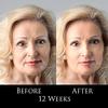 TRSDIANA DMAE Anti-Aging Moisturizer - Premium Anti-Aging, for Face and Neck, Moisturizes, perfect for Oily, Dry, and Sensitive Skin, Natural Blend of Vitamin E, Caviar, Aloe, Green Tea Antioxidant, view 3