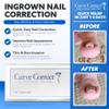 CurveCorrect Ingrown Toenail Treatment Kit - Ingrown Toenail Corrector Kit with 10 Braces - at Home Ingrown Toenail Correction - Big Toe Ingrown Nail Removal view 4