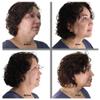 Bring It Up Instant Neck Lift Tape 30 Day Supply, Transparent Neck Lifting Anti Wrinkle Stickers - Tones Sagging Necklines Instantly - Made in USA view 2