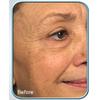 Biologic Stem Cell Wrinkle Therapy - (Set of 2) view 2